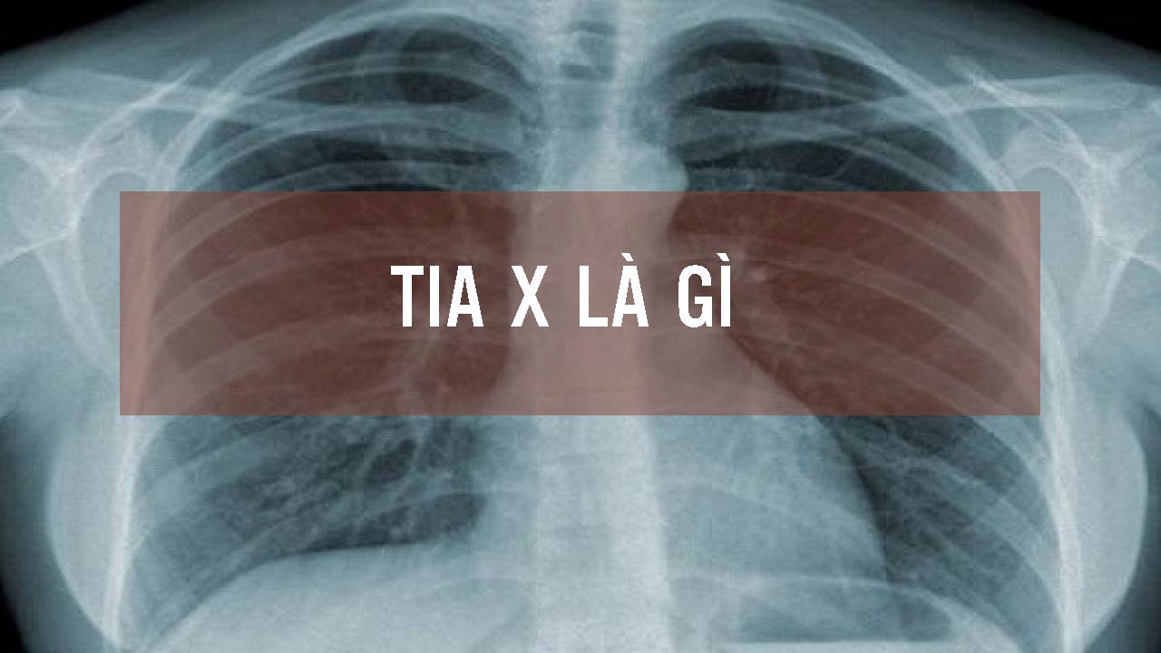 Khái niệm tia X là gì?